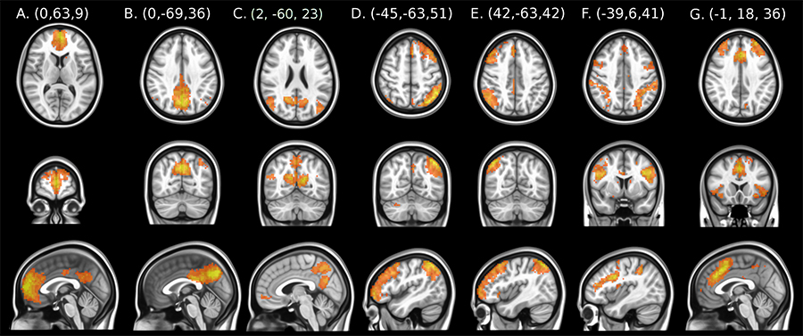 Seven cognitive control resting-state connectivity images. From left to right: anterior default mode network (DMN), (B) the posterior DMN, (C) the precuneus DMN, (D) the left frontoparietal network, (E) the right frontoparietal network, (F) the dorsa